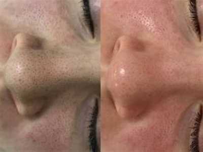 آموزشگاه مراقبتهای زیبایی و سالن عروس هلهله
