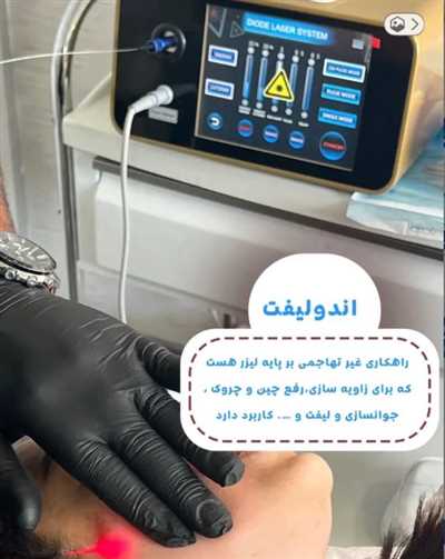 جشنواره تابستانی لاغری اندولیفت شکم،پهلو و بازو