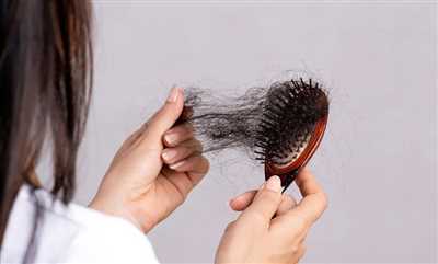 آیا ریزش مو در بارداری طبیعی است؟ + راهنمای جامع