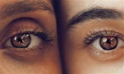 بهترین کرم برای سیاهی دور چشم؛ چطور سیاهی دور چشم‌ها را از بین ببریم؟