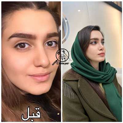 ۵ نکته ساده ولی تضمینی برای انتخاب بهترین دکتر عمل بینی!