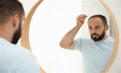ماینوکسیدیل چیست؟ تفاوت ۲٪ و ۵٪، نحوه مصرف و عوارض