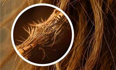 موخوره چیست و چرا ایجاد می‌شود؟ راه‌های پیشگیری و مراقبت از مو