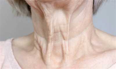 خطوط گردن چرا ایجاد می‌شوند؟ + بهترین راه‌های از بین بردن خطوط گردن