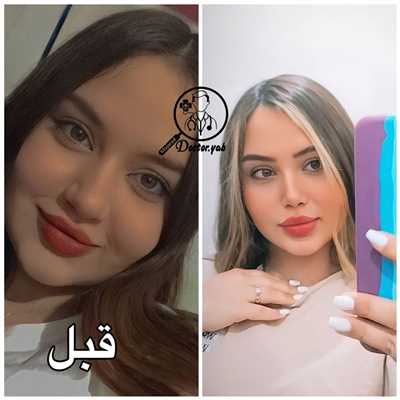 ۵ نکته ساده ولی تضمینی برای انتخاب بهترین دکتر عمل بینی!