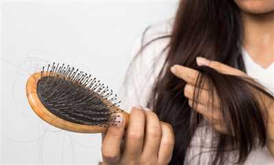 5 تا از بهترین قرص آهن برای ریزش مو از نظر کاربران