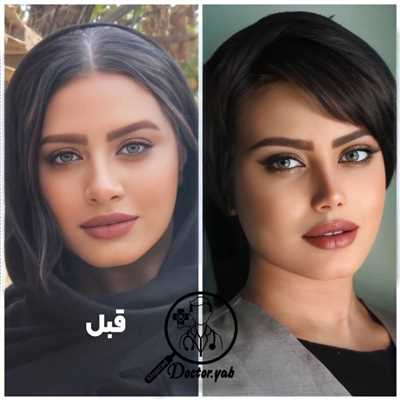 ۵ نکته ساده ولی تضمینی برای انتخاب بهترین دکتر عمل بینی!