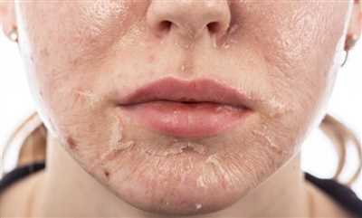 پیلینگ صورت چیست؟ فواید و عوارض پیلینگ صورت که باید بدانید!