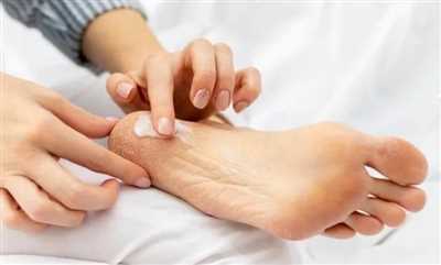 کرم ترک پا میسوری خوبه؟ + نحوه استفاده از این کرم
