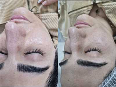 فیشال vip پوست دهیدراته خشک با آبرسانی و مواد مغذی 