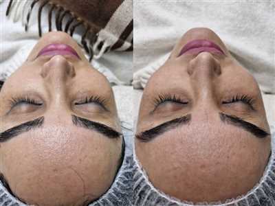 فیشال vip پوست دهیدراته خشک با آبرسانی و مواد مغذی 